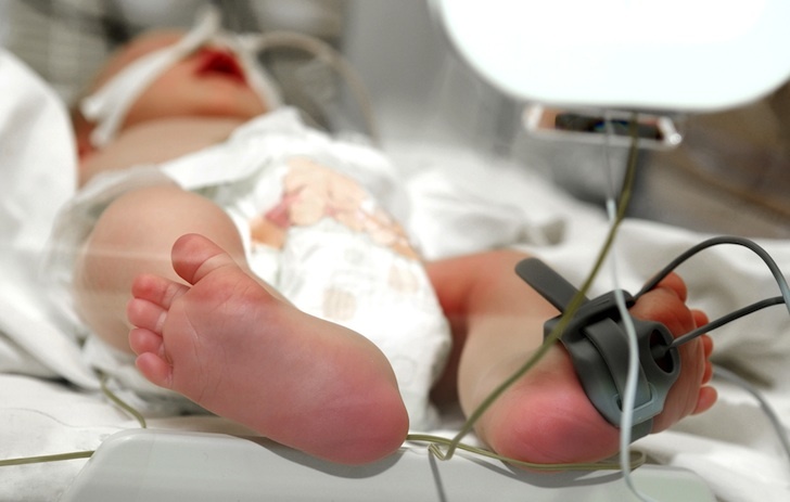 Bebeluş cât o sticlă de apă născut în ambulanţă