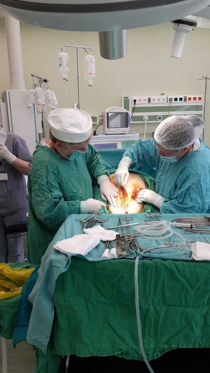 Tumoră gigant operată la Maternitate