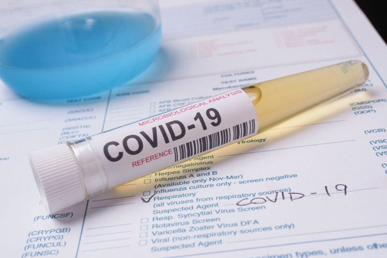 Numărul cazurilor noi cu COVID-19 se menține ridicat