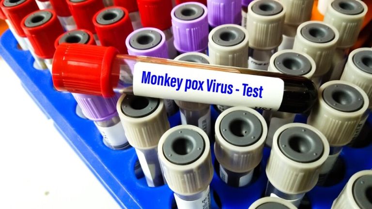 Italia a înregistrat 20 de cazuri de variola maimuţei