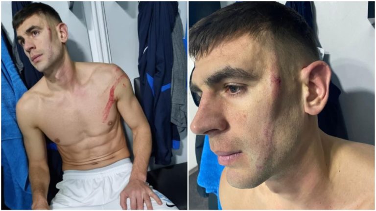 Un căpitan din SuperLigă, desfigurat după intrarea de K1 al unui fost mijlocaș al FC Botoșani